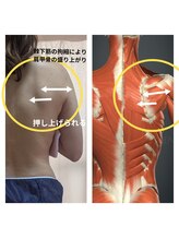 紬(TSUMUGI)/背中の盛り上がりはコリ