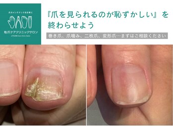 地爪ケアクリニックサロン 八戸店
