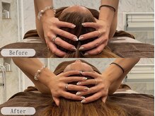 ルルミリ 心斎橋(Lulumili)/すっきり小顔矯正ケア