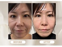 トロワ(TROIS)/輪郭のラインが変わる