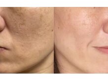 セルフエステBB あけのアクロス店/解放感ある受付♪