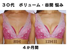 バストサロン メルベイユ(Merveile)の雰囲気(デコルテ、谷間ふっくらボリュームUP♪12回、4ヶ月)