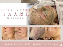 グランヴェルジェ(Granverger)
