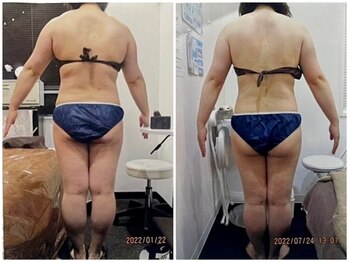 クイーン 札幌駅前店(Queen)/お客様 ビフォーアフター(11)