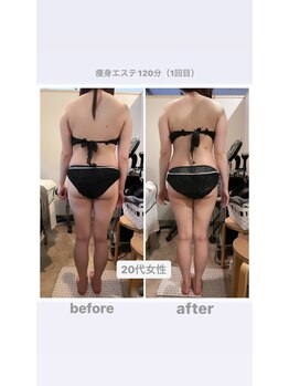 トランキーロ(Tranquilo)/腰やお尻を解すと小尻&腰痛解消