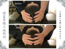 ボディ リセット アンド デザイン(Body Reset & Design)/【施術例】ビフォーアフター