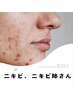【根本改善★ニキビ予防コース/ニキビケアコース】【全6回】2ヶ月～3ヶ月