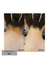 ブルームーン(BLUE MOON)/うなじ脱毛デザインシェービング