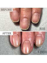 ビエル(BIeL)/京都　パラジェル　フィルイン