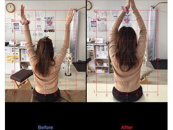 ストレチックス 近江八幡店/BeforeAfter