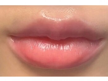 ラヌイ(LANUI)の写真/《唇の黒ずみが気になる方へ♪》最新エイジングケア技術で理想のお肌へ！お悩みに寄り添い施術いたします！