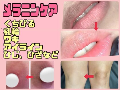 オンリーホープ(ONLY HOPE)の写真