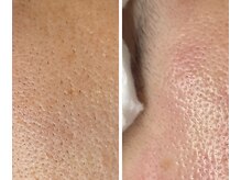 サイ(Sai)/before⇒after