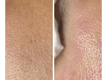 サイ(Sai)/before⇒after