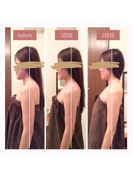 シナジェ 岡山店(Synergye)/デコルテ&二の腕まで美しく