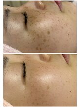 エステティックサロン アールグレー/ホワイトブレイズ