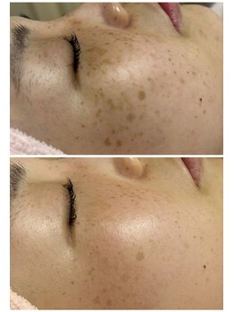 エステティックサロン アールグレー/ホワイトブレイズ