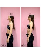 ククナ 長岡西店(KUKUNA)/バストケアコース