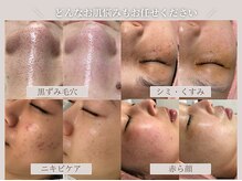ベストベル(BestBelle)の雰囲気（様々なお肌悩みに特化したメニューを多数ご用意しております◎）