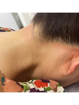 シーカラー 中野栄店(C.color)の写真/はじめての脱毛に◎駅近＆学割＆都度払いで始めやすい！新生活キャンペーン実施中♪