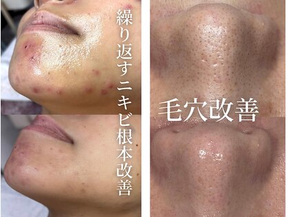 ココリールの写真