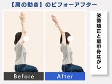 堺 中百舌鳥駅前整体院/肩甲骨はがし♪