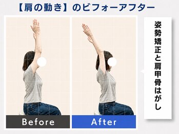 堺 中百舌鳥駅前整体院/肩甲骨はがし♪