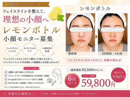 ルーチェ カリーノ(Luce Carino)の写真