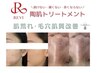 【赤ちゃんの様なたまご肌♪】頑固な肌荒れ改善＆毛穴汚れ×筋膜リリース