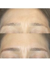 アストリア(ASTORIA)/3Dブロウリフト