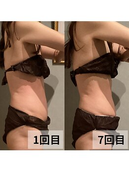 セイリキ(SEIRIKI)/★痩身ダイエットお客様のお声★