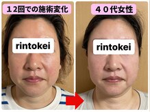 凛と慶/ビフォーアフター