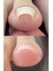 エージェーネイルズ(AJ Nails)の写真/*口コミ高評価*【巻き爪補正 親指1ヶ所￥12800】辛い悩みご相談下さい!足元のケアもできるサロン[麻布十番]