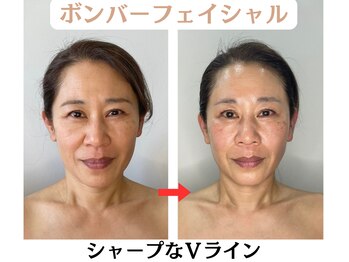コトハ(cottha)/1回施術後