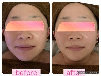 ベルフルールエム(Belle Fleur.M)/小顔☆