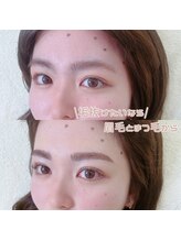 アイル バイ エドゥース(I'LL by et Douce)/まつげパーマ×眉毛WAX