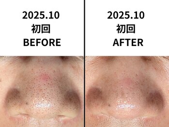 美鼻ラボ 押上 曳舟