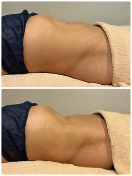 ビューティーサロン ラグジューム(Beauty salon Laxum)/赤岩式腸けずり