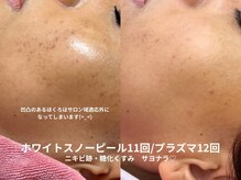 ピブ(pib.)/1年間での成果｜努力の賜物です