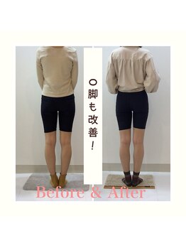 スタイルラボ高松/産後の骨盤矯正の効果♪