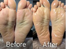 プレヴナンス(Prevenance)