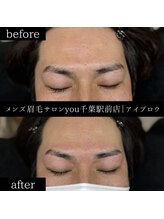 ユー 千葉駅前店(you)/ビフォ－アフター写真