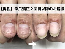 深爪矯正専門ネイルサロン アニューの雰囲気(深爪/噛み爪/むしり癖にお悩みお任せください♪メンズも大歓迎!)