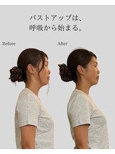リ バース 立川(RE:birth)/美胸　BeforeAfter