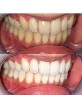 ライトビューティー 池袋店(LightBeauty)/症例写真