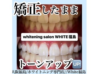 ホワイトニングサロン ホワイト(WHITE)/セルフホワイトニング/大阪/福島