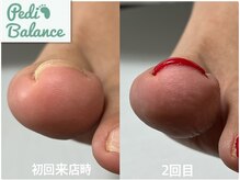 エムズ(m's)の雰囲気（ペディバランス☆巻き爪ケアに特化したジェルでの施術）