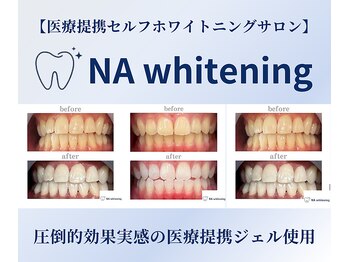 エヌエーホワイトニング たまプラーザ店(NAホワイトニング)