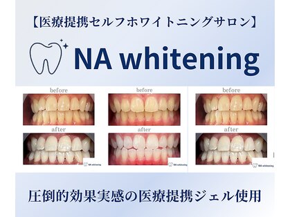 エヌエーホワイトニング たまプラーザ店(NA whitening)の写真