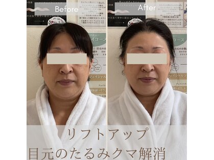 ル グラン ヤマテ(Le grand Yamate)の写真